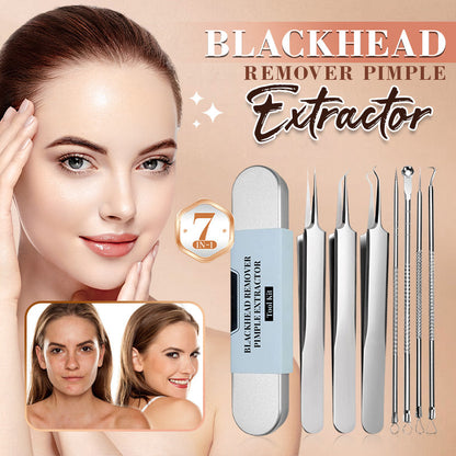 💓HOT SALE💥Stainless Steel Blackhead Remover Tool Kit