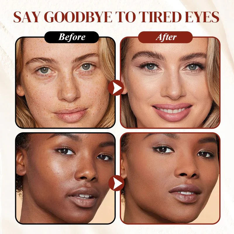 ✨ LAST DAY PROMOTION - BUY 1 GET 1 FREE ✨Colored Clay Undereye Corrector