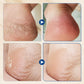 🎉Buy 1 Get 1 Free🎉Hydrating and Anti-Cracking Foot Cream