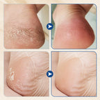 🎉Buy 1 Get 1 Free🎉Hydrating and Anti-Cracking Foot Cream