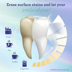 💗LAST DAY PROMOTION - 50%OFF Whitening Strips (7-day treatment)