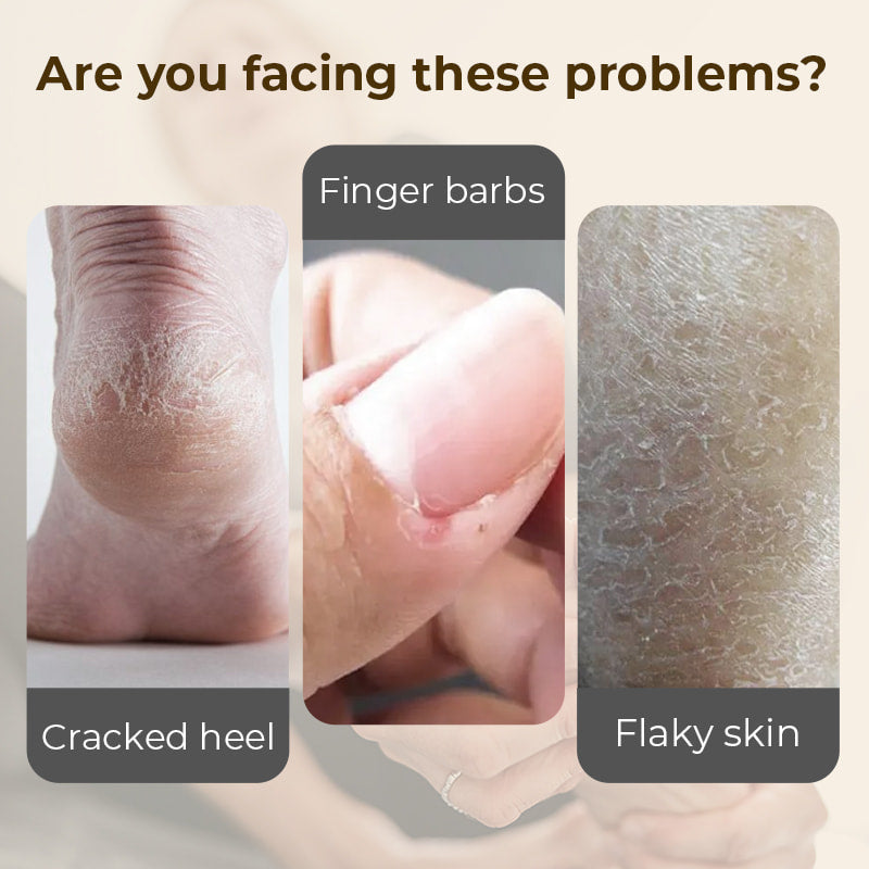 🎉Buy 1 Get 1 Free🎉Hydrating and Anti-Cracking Foot Cream