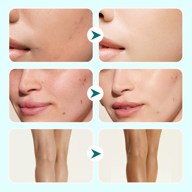 💜LAST DAY - BUY 1 GET 1 FREE💜All-in-One Moisturizing Concealer Waterproof Cream For Women