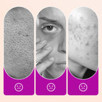 💗LAST DAY - BUY 1 GET 1 FREE💗Flawless Brightening Under Eye Concealer